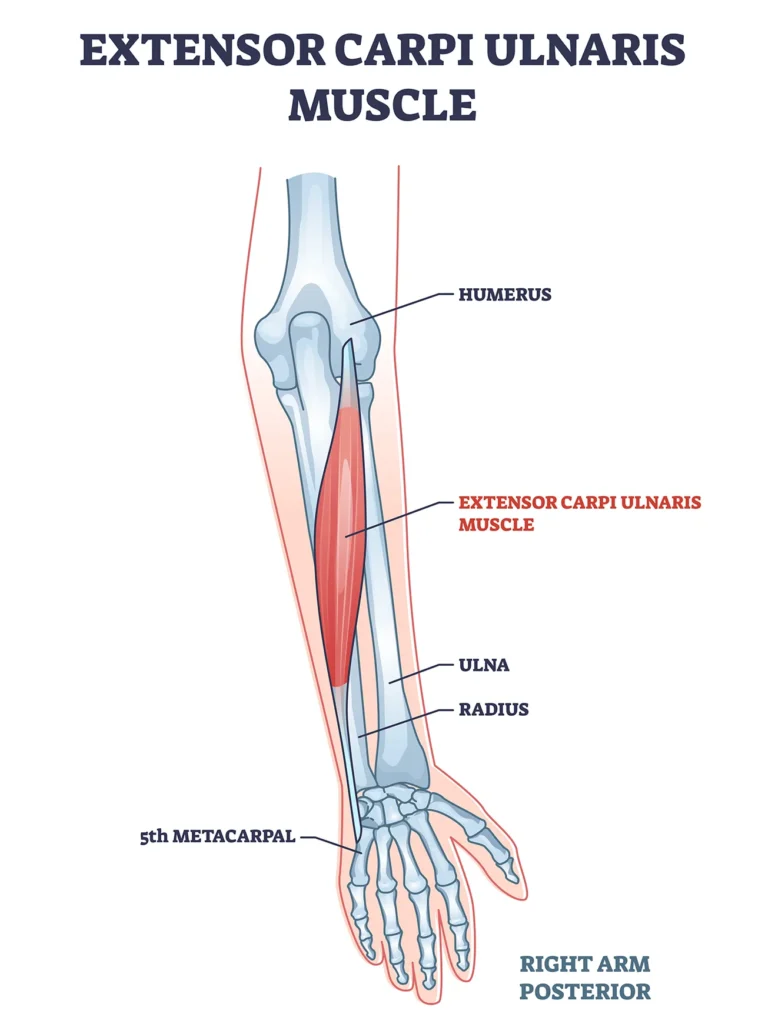 Illustrazione anatomica dei muscoli che creano dolore al gomito del tennista