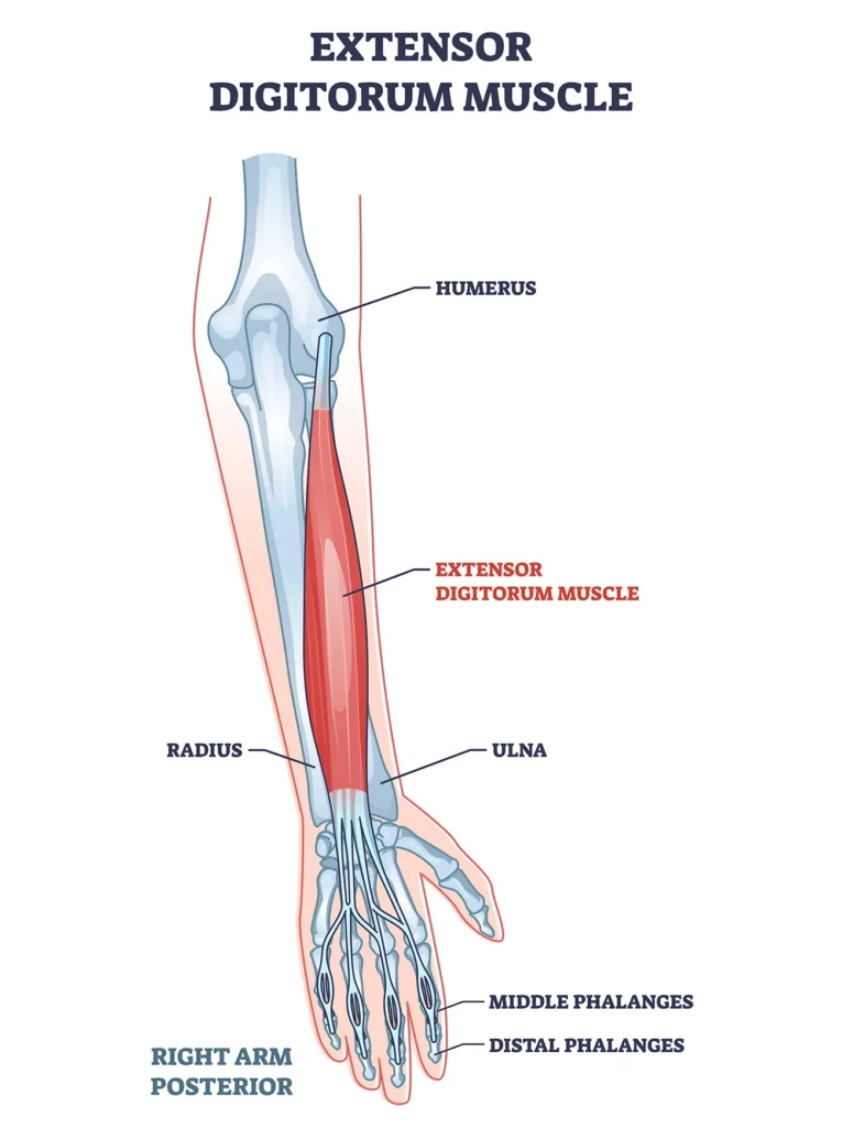 Illustrazione anatomica dei muscoli che causano epicondilite